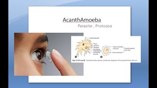 Ophthalmology 121 a AcanthAmoeba Keratitis Pseudo Dendrites eye cornea Contact lens PHMB [upl. by Macmullin]