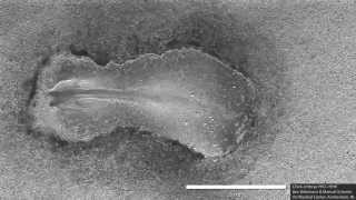 Embryological Development of GastroIntestinal Tract  ACLAND [upl. by Cherry]