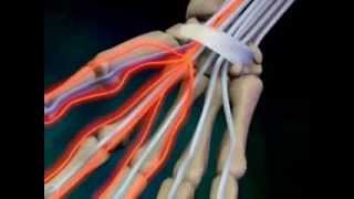 Early symptoms and warning signs of carpal tunnel syndrome [upl. by Nevile]