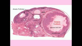 12DaysinMarch Ovarian Tumors for USMLE Step One [upl. by Gray603]