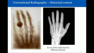 Introduction to Radiology Conventional Radiography [upl. by Yrellav193]