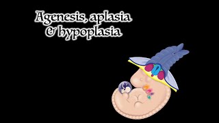 What is Cerebellar Hypoplasia [upl. by Elstan]