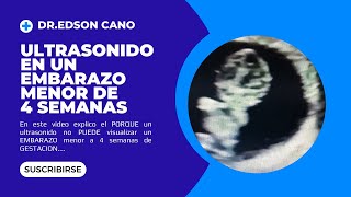 Ultrasonido En Un Embarazo Menor de 4 SemanasDR EDSON CANO [upl. by Sillad183]