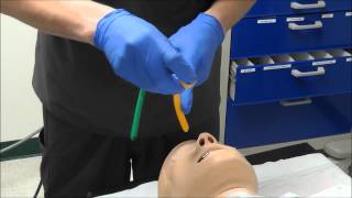 Nasal Intubation [upl. by Airt]