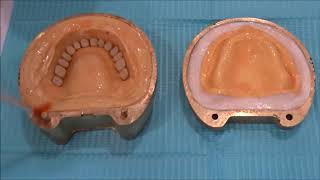 Processing of Complete dentures [upl. by Ennylhsa]