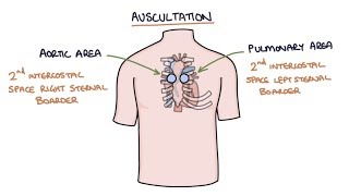 Heart Murmurs and Heart Sounds Visual Explanation for Students [upl. by Winne672]