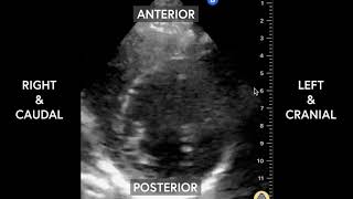 Normal Parasternal Short Axis [upl. by Lodnar84]