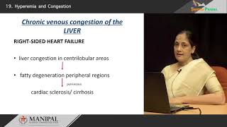 Hyperemia amp Congestion [upl. by Eceinwahs]