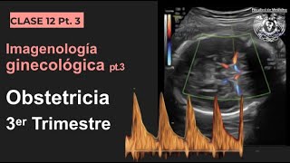 123  Imagen en Obstetricia 3er Trimestre [upl. by Read]